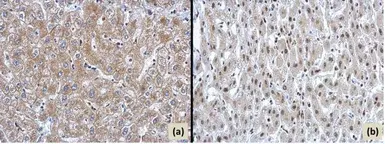 Anti-ARID2 antibody used in IHC (Paraffin sections) (IHC-P). GTX129444