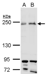 Anti-ARID2 antibody used in Western Blot (WB). GTX129444
