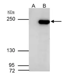 Anti-ARID2 antibody used in Immunoprecipitation (IP). GTX129444