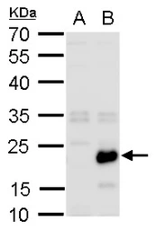 Anti-RGS19 antibody used in Western Blot (WB). GTX129456