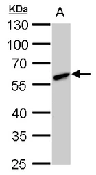 Anti-CLN3 antibody used in Western Blot (WB). GTX129457