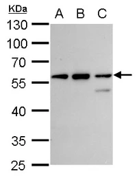 Anti-CLN3 antibody used in Western Blot (WB). GTX129457