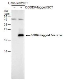 Anti-Secretin antibody used in Western Blot (WB). GTX129460