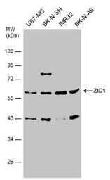 Anti-ZIC1 antibody used in Western Blot (WB). GTX129468