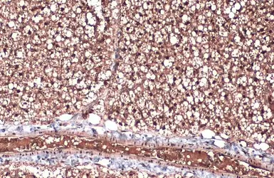 Anti-ZIC1 antibody used in IHC (Paraffin sections) (IHC-P). GTX129468