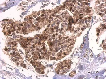 Anti-HMGB2 antibody used in IHC (Paraffin sections) (IHC-P). GTX129469