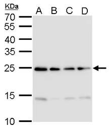 Anti-HMGB2 antibody used in Western Blot (WB). GTX129469