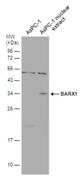 Anti-BarX1 antibody used in Western Blot (WB). GTX129470