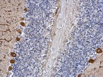 Anti-ICMT antibody used in IHC (Paraffin sections) (IHC-P). GTX129471