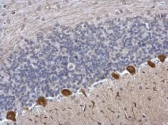 Anti-ICMT antibody used in IHC (Paraffin sections) (IHC-P). GTX129471