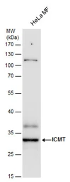 Anti-ICMT antibody used in Western Blot (WB). GTX129471