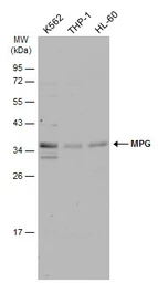 Anti-MPG antibody used in Western Blot (WB). GTX129483