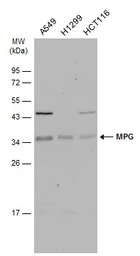 Anti-MPG antibody used in Western Blot (WB). GTX129483