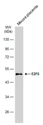 Anti-E2F5 antibody used in Western Blot (WB). GTX129491