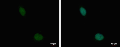 Anti-TRRAP antibody used in Immunocytochemistry/ Immunofluorescence (ICC/IF). GTX129505