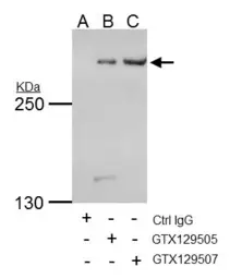 Anti-TRRAP antibody used in Immunoprecipitation (IP). GTX129505