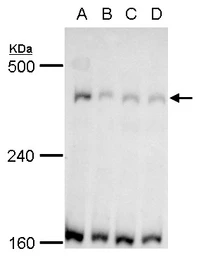 Anti-TRRAP antibody used in Western Blot (WB). GTX129505