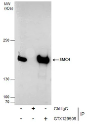 Anti-SMC4 antibody used in Immunoprecipitation (IP). GTX129509