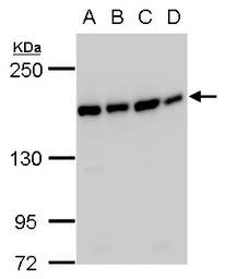 Anti-SMC4 antibody used in Western Blot (WB). GTX129509