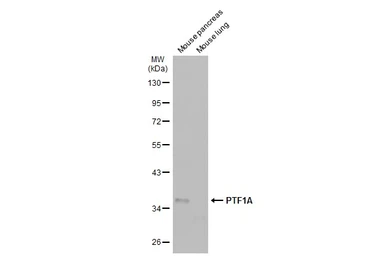 Anti-PTF1A antibody used in Western Blot (WB). GTX129525