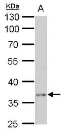 Anti-PTF1A antibody used in Western Blot (WB). GTX129525