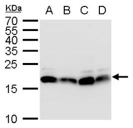 Anti-DNA polymerase epsilon 3 antibody used in Western Blot (WB). GTX129526
