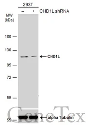 Anti-CHD1L antibody used in Western Blot (WB). GTX129527
