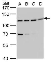 Anti-VPS34 antibody used in Western Blot (WB). GTX129528