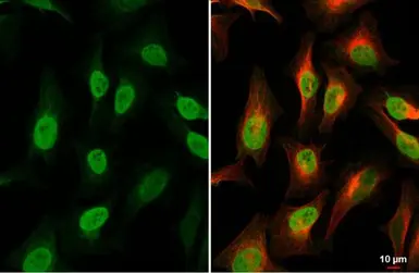 Anti-Histone H4 antibody used in Immunocytochemistry/ Immunofluorescence (ICC/IF). GTX129561