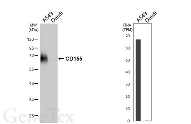 Anti-CD155 antibody used in Western Blot (WB). GTX129572