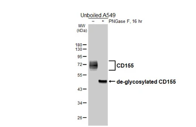 Anti-CD155 antibody used in Western Blot (WB). GTX129572