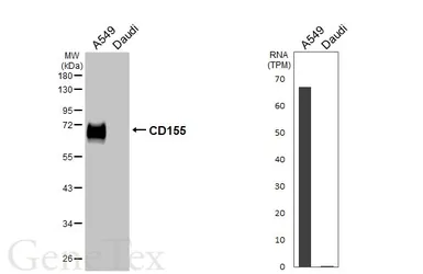 Anti-CD155 antibody used in Western Blot (WB). GTX129578