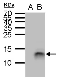Anti-Elafin antibody used in Western Blot (WB). GTX129582