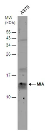 Anti-MIA antibody used in Western Blot (WB). GTX129590