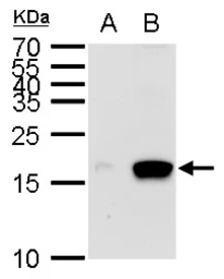 Anti-MIA antibody used in Western Blot (WB). GTX129590