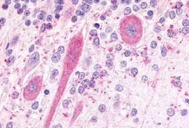 Anti-GPR81 antibody used in IHC (Paraffin sections) (IHC-P). GTX12960