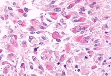Anti-GPR81 antibody used in IHC (Paraffin sections) (IHC-P). GTX12960