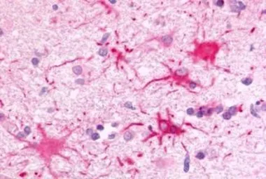 Anti-GPR81 antibody used in IHC (Paraffin sections) (IHC-P). GTX12960
