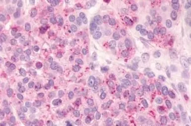 Anti-GPR81 antibody used in IHC (Paraffin sections) (IHC-P). GTX12960