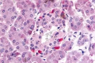 Anti-GPR81 antibody used in IHC (Paraffin sections) (IHC-P). GTX12960