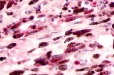 Anti-GPR81 antibody used in IHC (Paraffin sections) (IHC-P). GTX12960