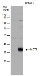 Anti-MCT2 antibody used in Western Blot (WB). GTX129600