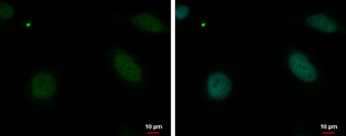 Anti-MBD4 antibody used in Immunocytochemistry/ Immunofluorescence (ICC/IF). GTX129605