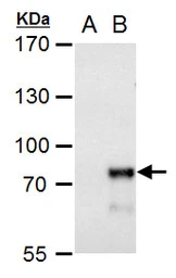 Anti-MBD4 antibody used in Western Blot (WB). GTX129605