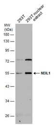 Anti-NEIL1 antibody used in Western Blot (WB). GTX129607