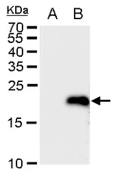 Anti-LMO4 antibody used in Western Blot (WB). GTX129616