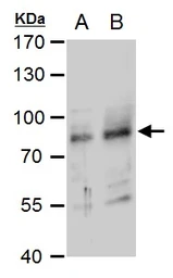 Anti-RNF168 antibody used in Western Blot (WB). GTX129617