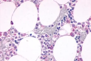 Anti-C5a R1 antibody used in IHC (Paraffin sections) (IHC-P). GTX12962