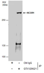 Anti-NCOR1 antibody used in Immunoprecipitation (IP). GTX129621
