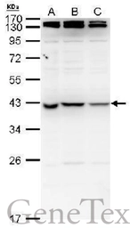 Anti-nm23-H7 antibody used in Western Blot (WB). GTX129626